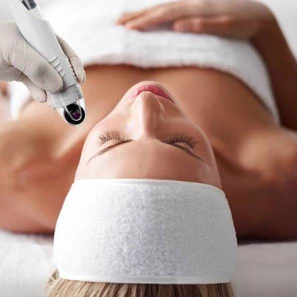 Skin needling