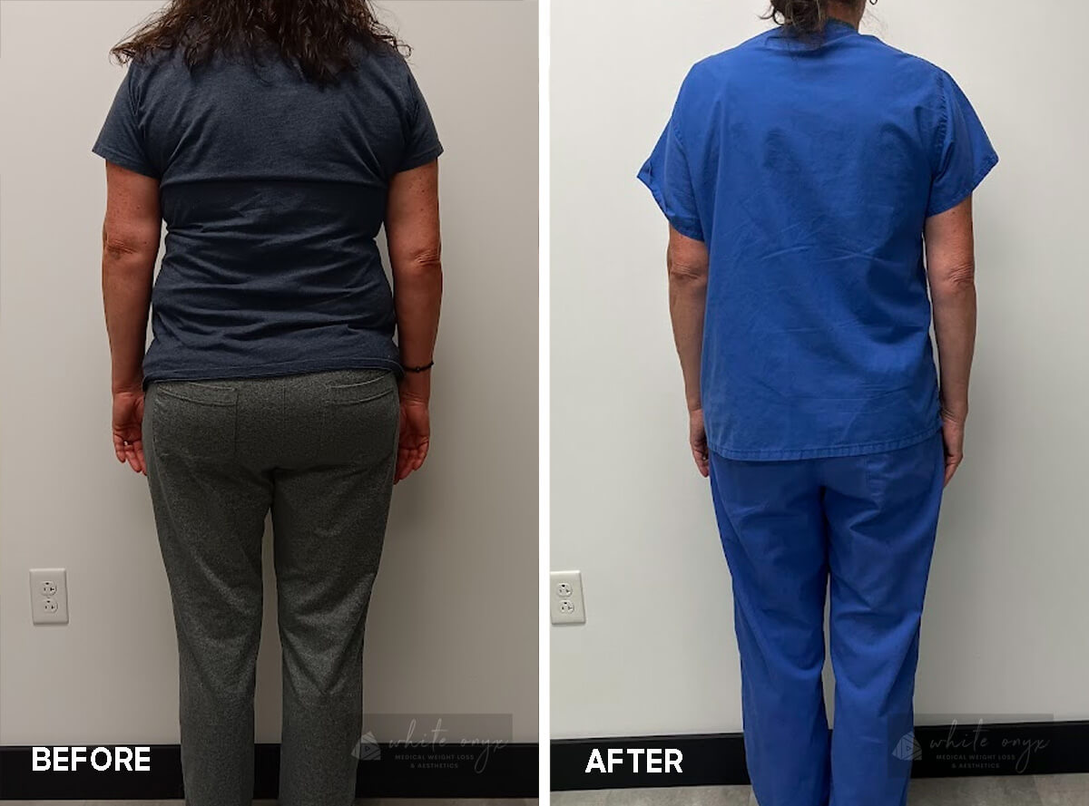 Medical Weight Loss – 6-3